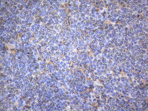 m01696 anti map3k8 mouse monoclonal antibody clone id oti2e3 ihc testing 4