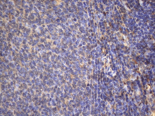 m01696 anti map3k8 mouse monoclonal antibody clone id oti2e3 ihc testing 5