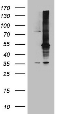m01696 anti map3k8 mouse monoclonal antibody clone id oti2e3 wb testing 1