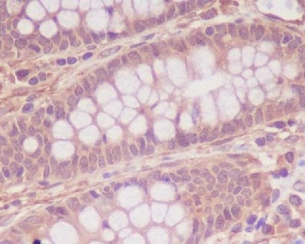 Immunohistochemical analysis of paraffin-embedded human colon, using Myosin light chain kinase Antibody