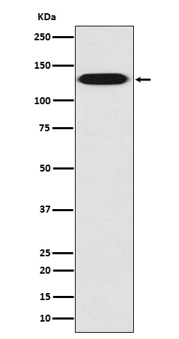 Western blot analysis of myosin light chain kinase expression in HUVEC cell lysate