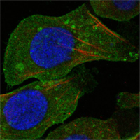 Confocal immunofluorescence analysis of A549 cells using DDR2 Monoclonal Antibody (green)
