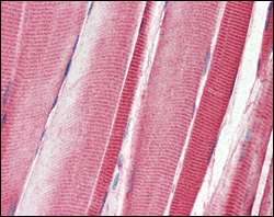 Immunohistochemistry analysis of paraffin-embedded human skeletal musle tissues with AEC staining using DDR2 Monoclonal Antibody