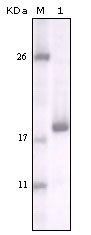 Western Blot analysis using DDR2 Monoclonal Antibody against truncated DDR2 recombinant protein