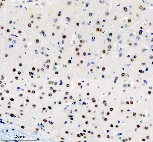 m01700 birc2 primary antibodies ihc testing 1