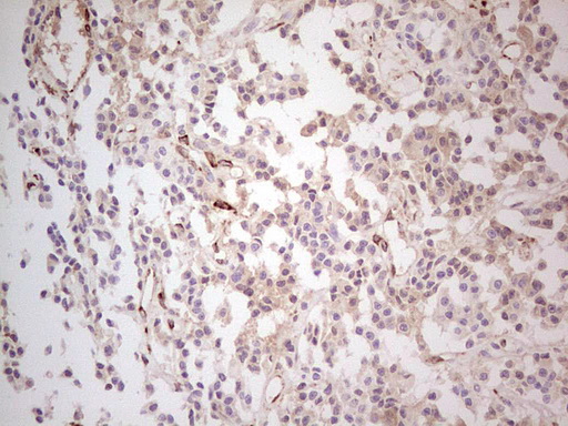 m01702 anti mgp mouse monoclonal antibody clone id oti11g6 ihc testing 2