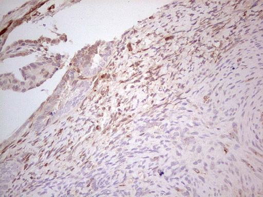 m01702 anti mgp mouse monoclonal antibody clone id oti11g6 ihc testing 3