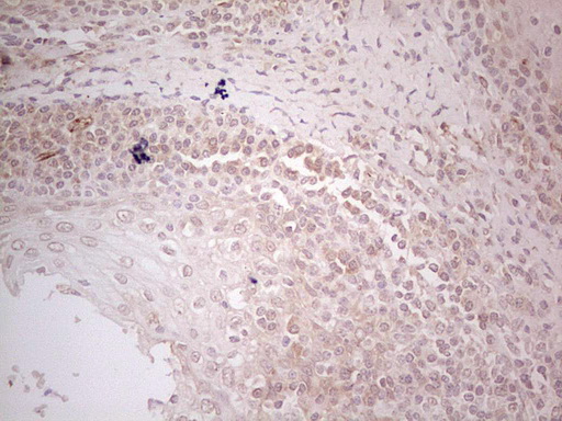 m01702 anti mgp mouse monoclonal antibody clone id oti11g6 ihc testing 4