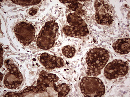 m01702 anti mgp mouse monoclonal antibody clone id oti11g6 ihc testing 5