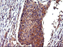 m01704 anti cep68 mouse monoclonal antibody clone id oti5b4 ihc testing 2