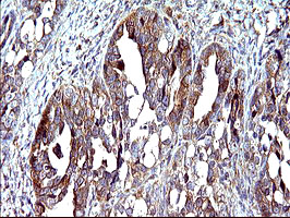 m01704 anti cep68 mouse monoclonal antibody clone id oti5b4 ihc testing 3