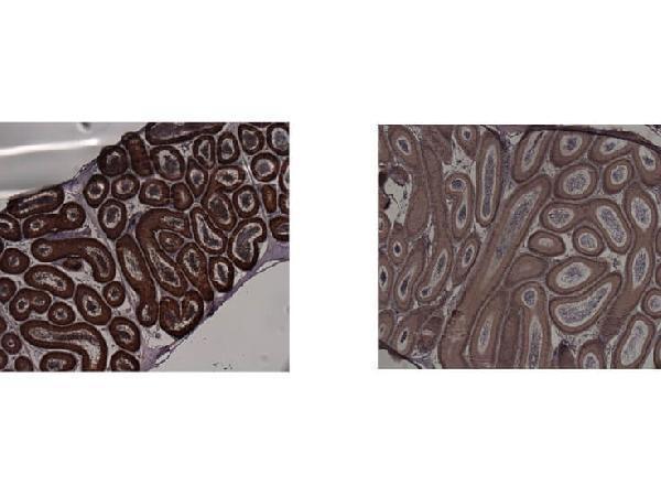 Immunohistochemistry of Mouse anti-IDO1 antibody