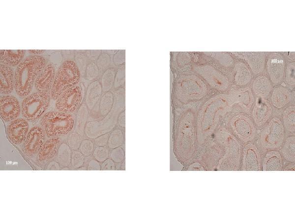 Immunohistochemistry of Mouse Anti-IDO1 Antibody