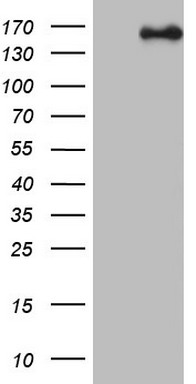 HEK293T cells were transfected with the pCMV6-ENTRY control (Left lane) or pCMV6-ENTRY NCOA2 (Right lane) cDNA for 48 hrs and lysed