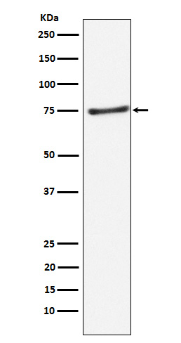 Western blot analysis of PIAS1 expression in Daudi cell lysate
