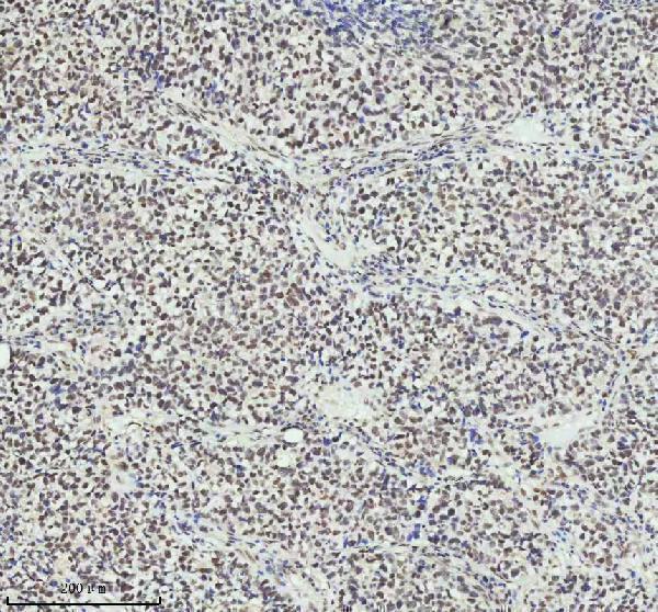 m01707 pias2 primary antibodies ihc testing 10