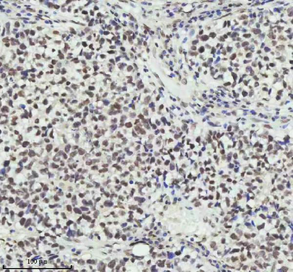 m01707 pias2 primary antibodies ihc testing 11