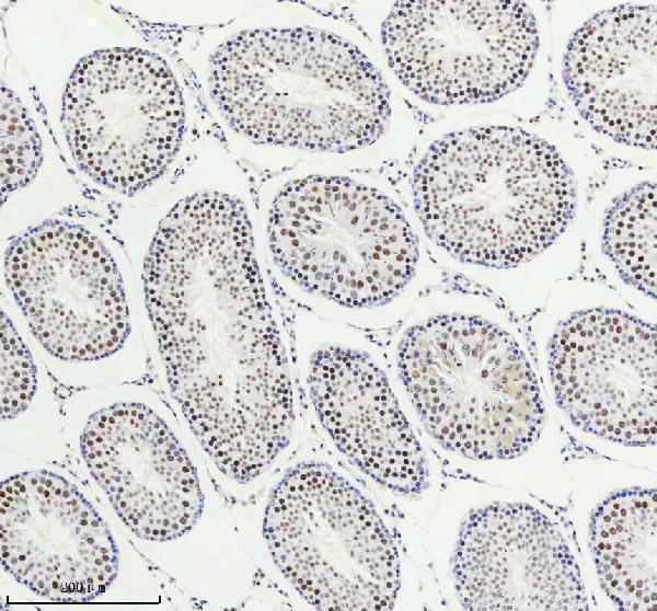 m01707 pias2 primary antibodies ihc testing 12
