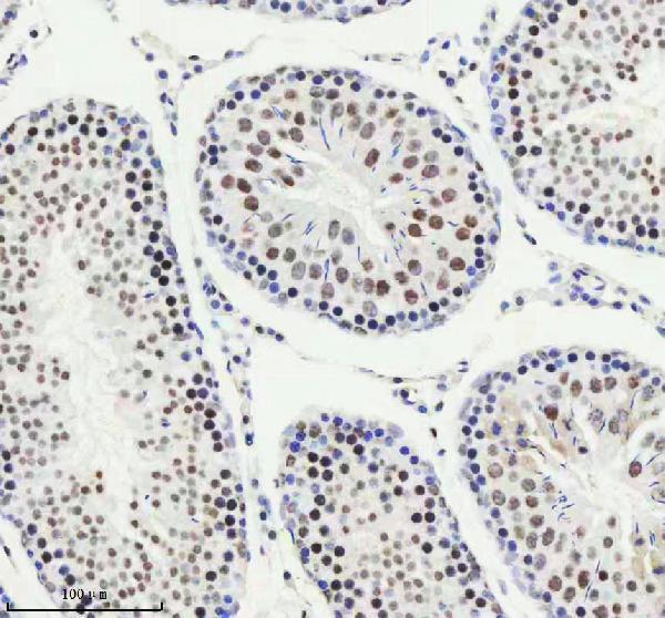 m01707 pias2 primary antibodies ihc testing 13