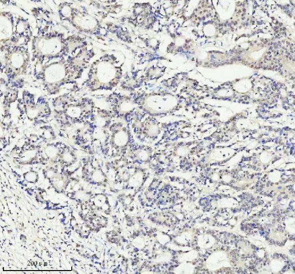 m01707 pias2 primary antibodies ihc testing 2