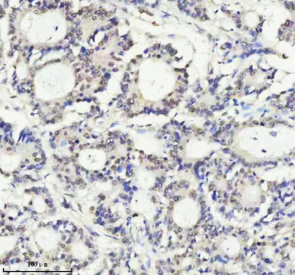 m01707 pias2 primary antibodies ihc testing 3