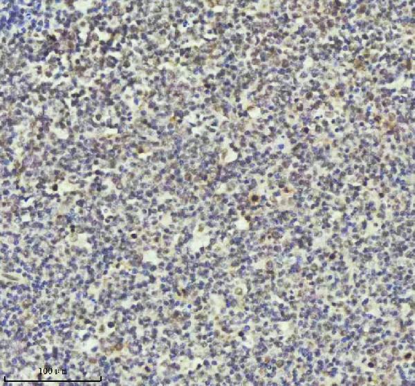 m01707 pias2 primary antibodies ihc testing 5