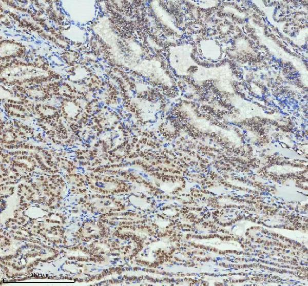 m01707 pias2 primary antibodies ihc testing 6