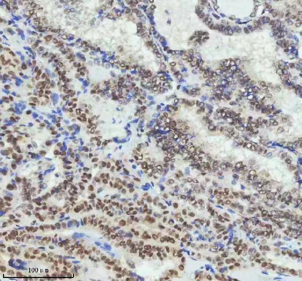m01707 pias2 primary antibodies ihc testing 7