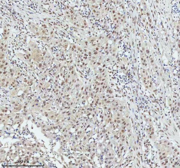 m01707 pias2 primary antibodies ihc testing 8