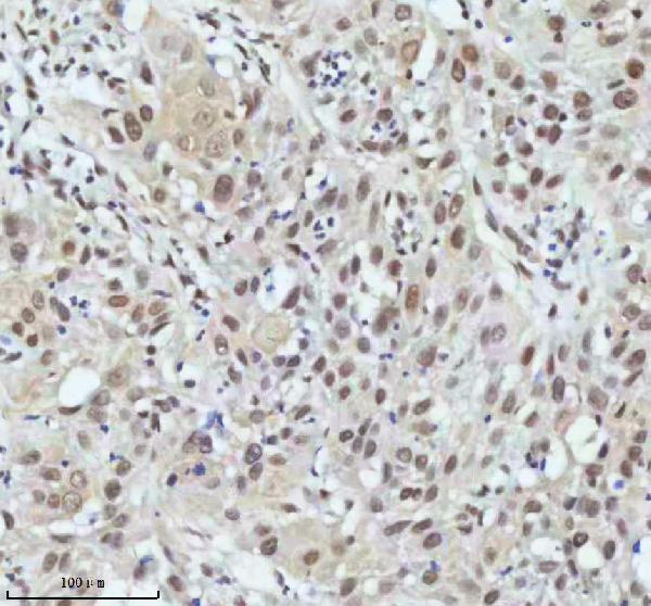 m01707 pias2 primary antibodies ihc testing 9