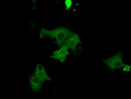 m01708 anti cgki prkg1 mouse monoclonal antibody clone id oti9g4 if testing 4