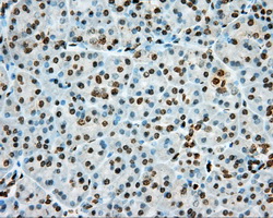 m01708 anti cgki prkg1 mouse monoclonal antibody clone id oti9g4 ihc testing 2