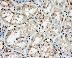 m01708 anti cgki prkg1 mouse monoclonal antibody clone id oti9g4 ihc testing 3