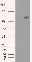 m01708 anti cgki prkg1 mouse monoclonal antibody clone id oti9g4 wb testing 1