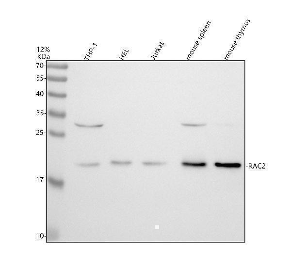 m01714 1 rac2 primary antibodies wb testing 1