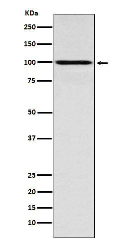 Western blot analysis of IFNGR1 expression in MCF7 cell lysate