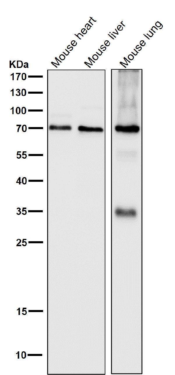 All lanes use the Antibody at 1:1W dilution for 1 hour at room temperature