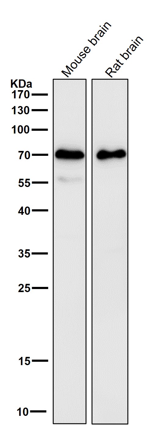 All lanes use the Antibody at 1:5K dilution for 1 hour at room temperature