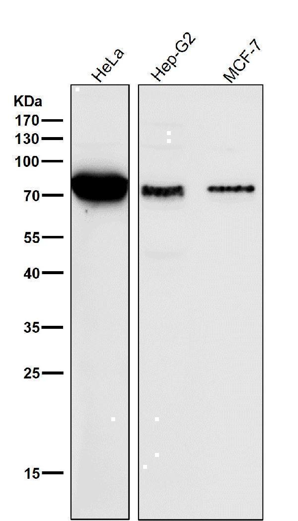 All lanes use the Antibody at 1:5K dilution for 1 hour at room temperature