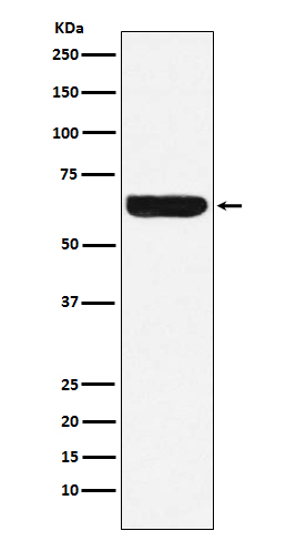Western blot analysis of Placental alkaline phosphatase (PLAP) expression in HeLa cell lysate