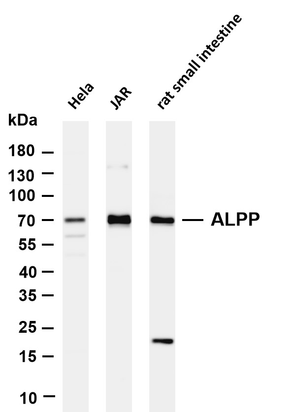 Various whole cell lysates were separated by 4-20% SDS-PAGE, and the membrane was blotted with anti-ALPP antibody