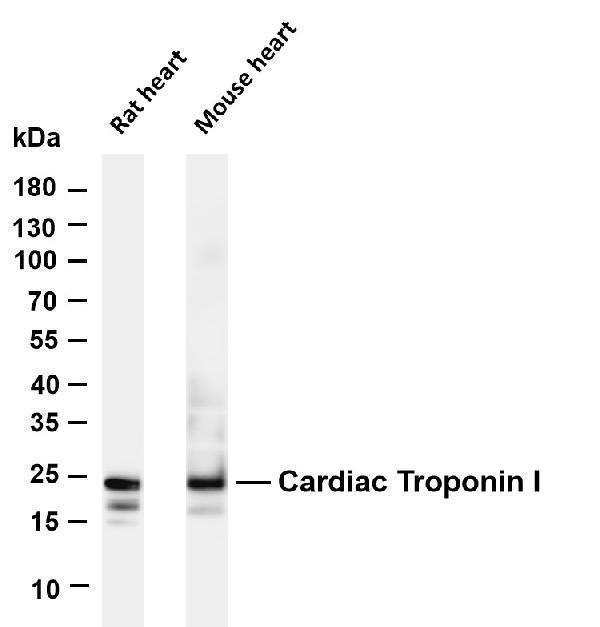 Various whole cell lysates were separated by 4-20% SDS-PAGE, and the membrane was blotted with anti-Cardiac Troponin I antibody