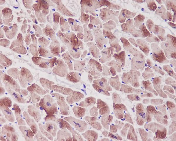 Immunohistochemical analysis of paraffin-embedded human heart, using Troponin I Antibody
