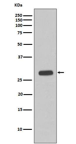 Western blot analysis of Troponin I expression in fetal heart cell lysate
