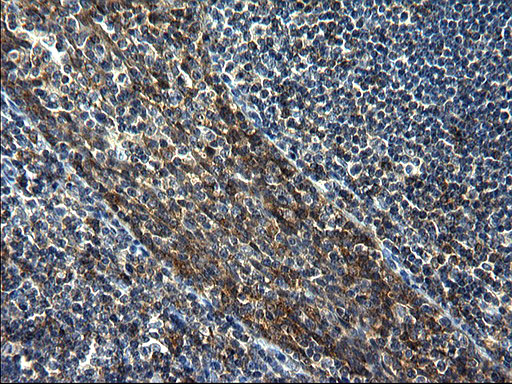 m01722 1 anti gclc mouse monoclonal antibody clone id oti1a3 ihc testing 5
