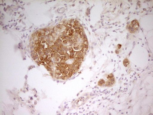m01723 pak4 primary antibodies ihc testing 10_1