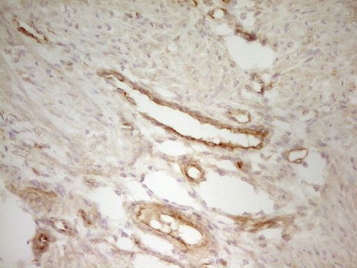 m01723 pak4 primary antibodies ihc testing 12_1