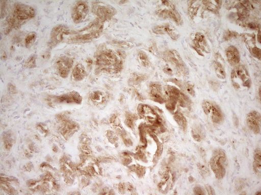 m01723 pak4 primary antibodies ihc testing 14_1