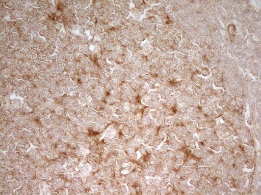 m01723 pak4 primary antibodies ihc testing 15_1