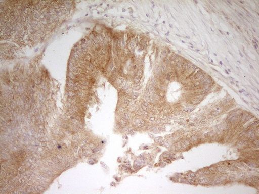 m01723 pak4 primary antibodies ihc testing 5_1